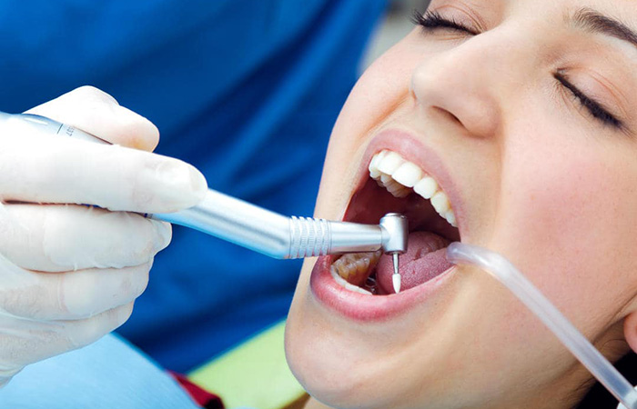 Porcelain-Tooth-Fillings-and-Restorations-services