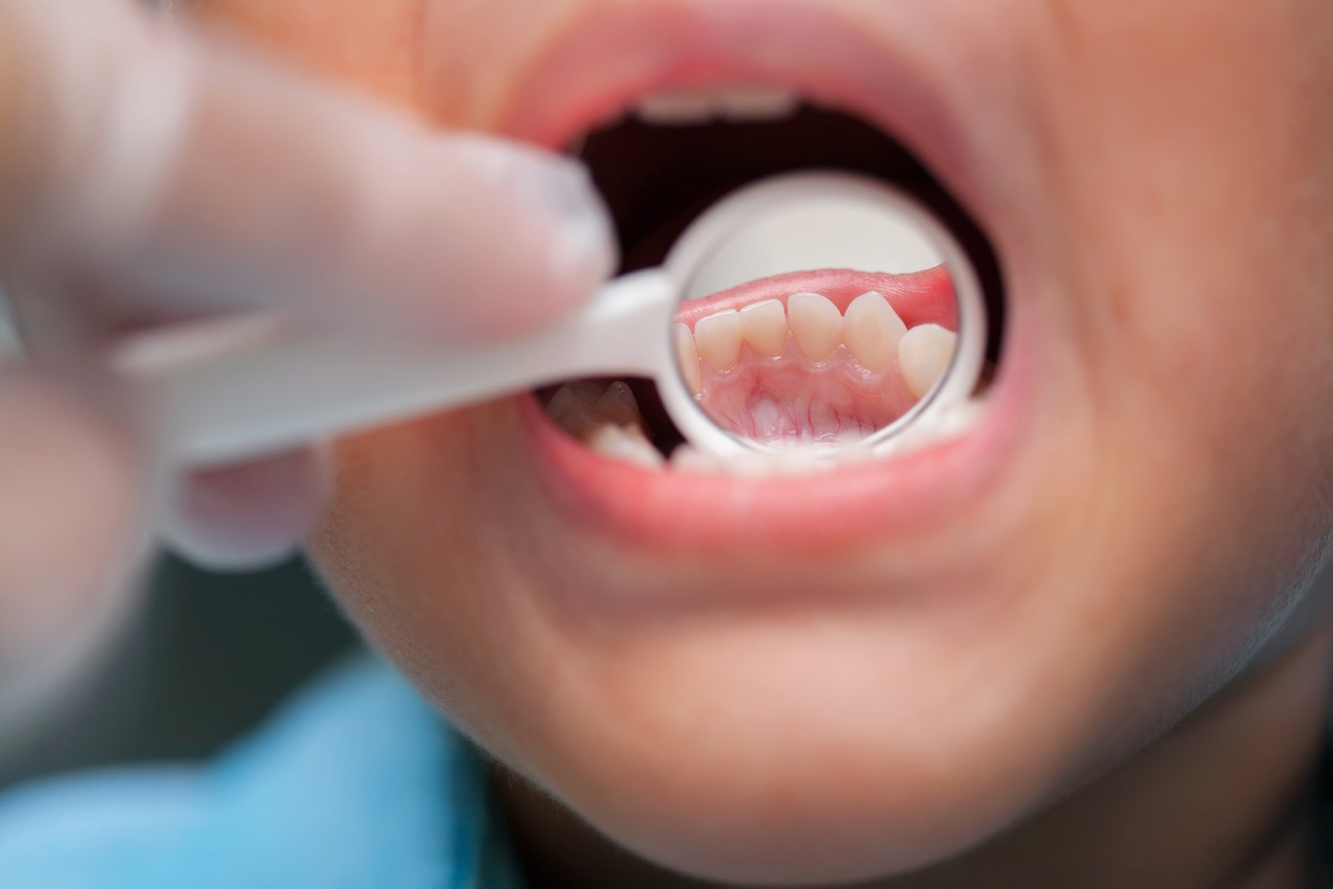 gum disease